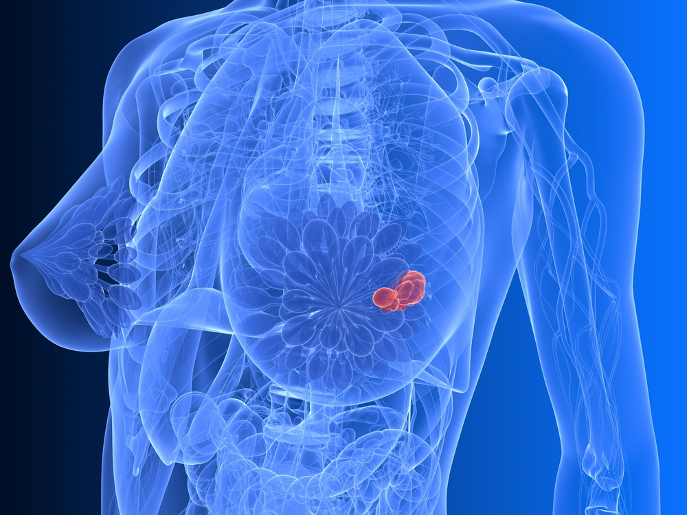 you-should-know-the-truth-about-dense-breast-tissue-cancer-awareness-buzz